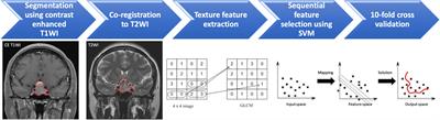 Radiomics Approach for Prediction of Recurrence in Non-Functioning Pituitary Macroadenomas